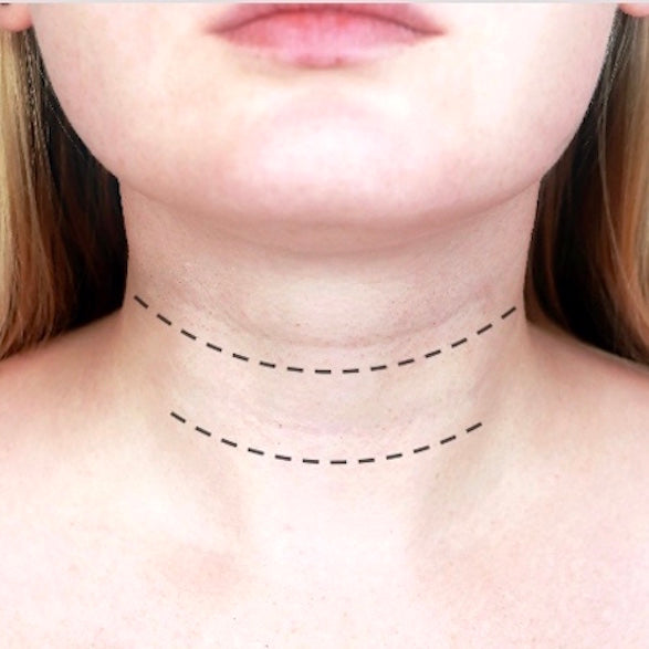 A woman with horizontal lines in her neck that are a symptom of tech neck