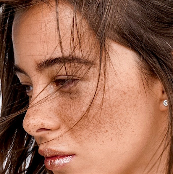 A woman with freckles on her face, a sign of sun damage