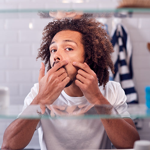 A man with adult acne squeezing a pimple