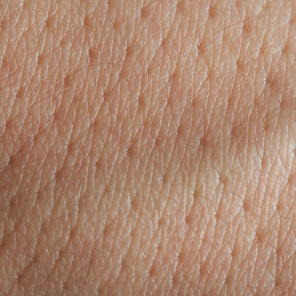 Closeup of skin showing pores that are big