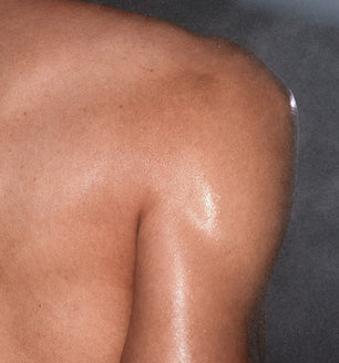 Upper back and shoulder after using SLMD by Dr. Pimple Popper Salicylic Acid Body Spray for acne