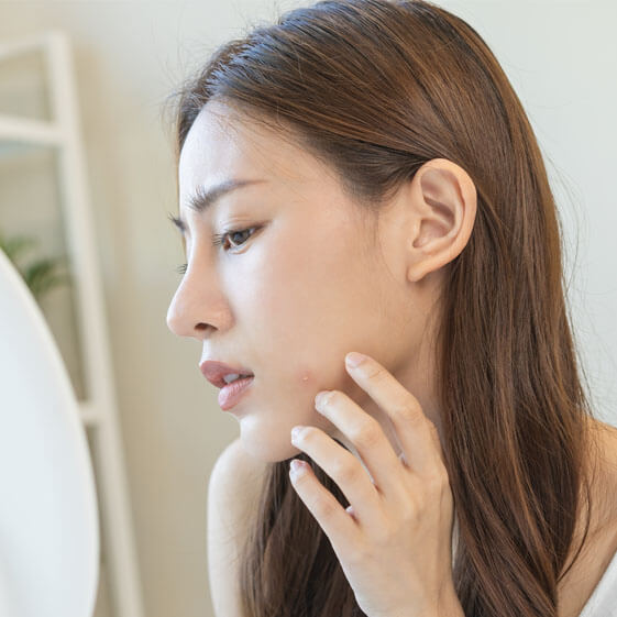 A woman looking at her pimple before applying a spot treatment