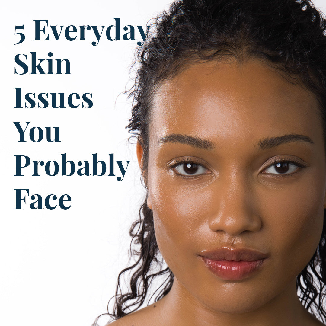 5 Everyday Skin Issues That You Probably Face (That We Can Fix)