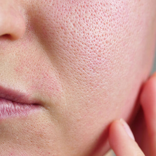 A woman with visible pores on her cheek