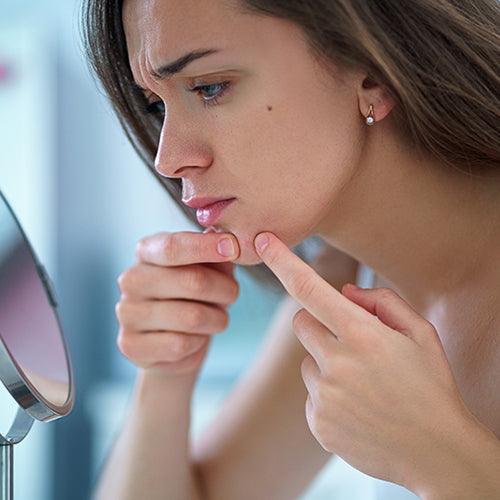 A woman examining her random acne breakout