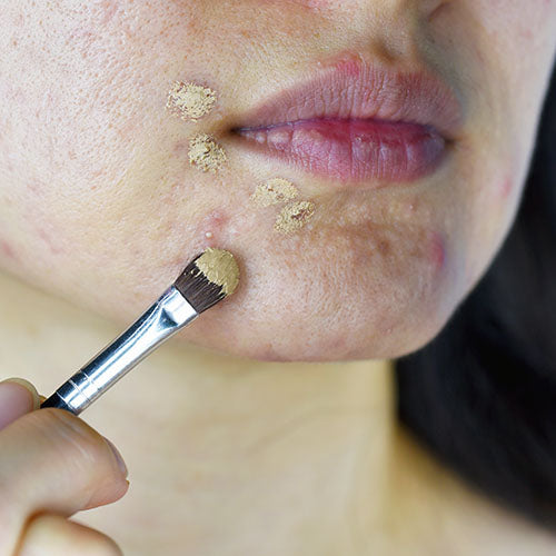 A woman covering up a pimple with concealer makeup