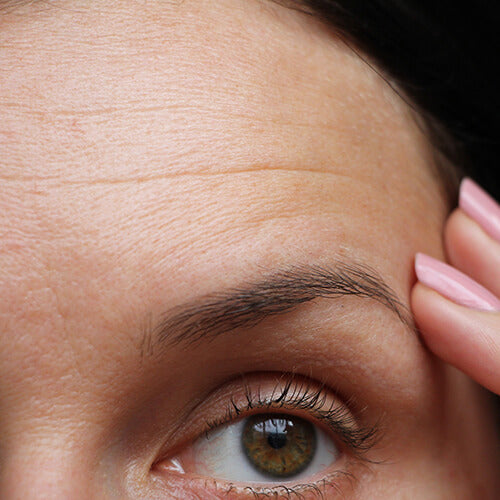 A woman with forehead wrinkles showing skin aging