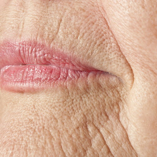 A woman with wrinkled and sagging skin that's aging
