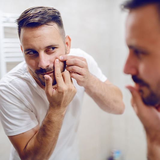 Man popping pimple before using Spot Check Acne Patches by SLMD Skincare
