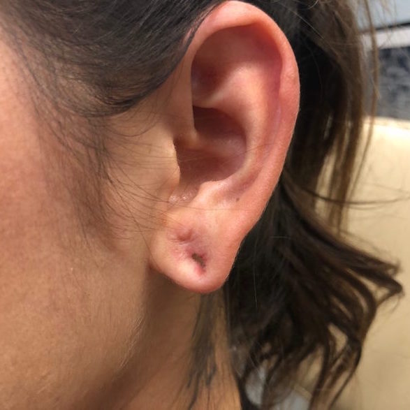 Getting Your Ears Pierced: What to Expect