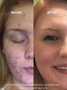 Salicylic Acid Cleanser