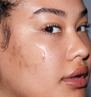 A woman using SLMD by Dr. Pimple Popper Retinol Serum for acne and well aging
