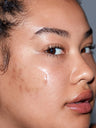 A woman applying SLMD Retinol Serum by Dr. Pimple Popper